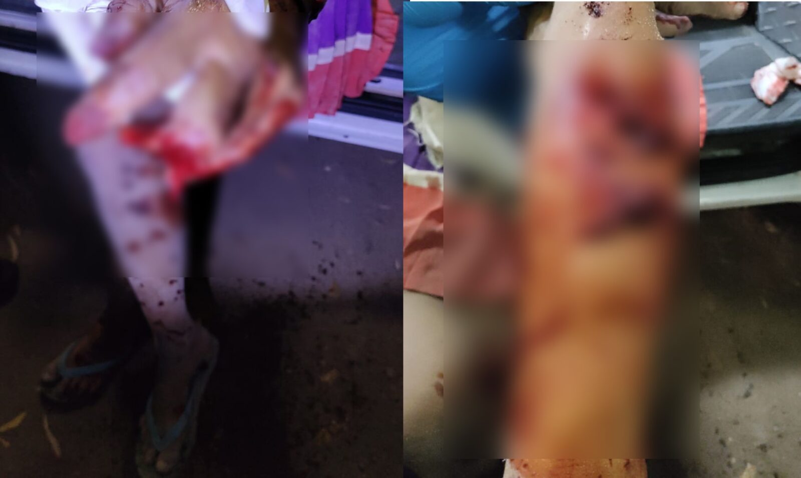 Lesiones por ataque de perro en ejido México. Foto: Fidel Hernández